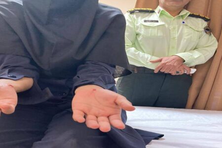 حمله سگ‌های بدون صاحب به یک زن تنها