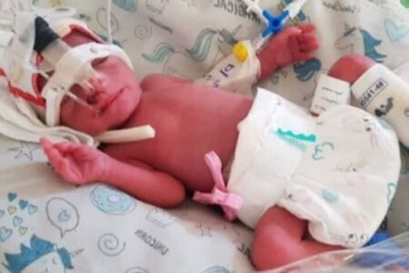 هزینه‌های درمانی و شیرخشک ۴ قلوهای کرمانی تا ۲ سالگی رایگان شد