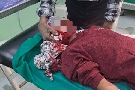 پسر ۱۴ ساله راوری، اولین مصدوم چهارشنبه‌سوری در استان کرمان 