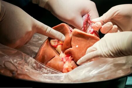 کبد جوان ۲۲ ساله کرمانی به یک بیمار در شیراز زندگی بخشید