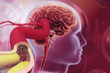 احتمال ارتباط ژنتیکی آلزایمر با بیماری قلبی | اخبار اصلاحات