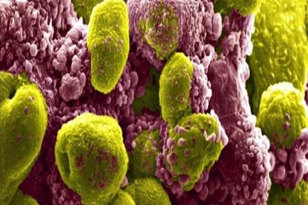 سرطان پروستات چهارمین سرطان شایع در استان کرمان است | خبر کرمان