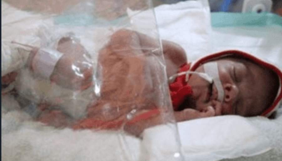 نجات مادر باردار و نوزاد دچار سوختگی